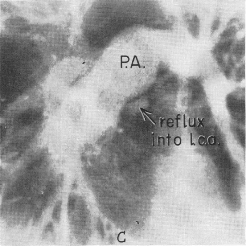 Fig. 4C.