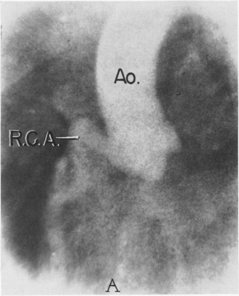 Fig. 4.B.