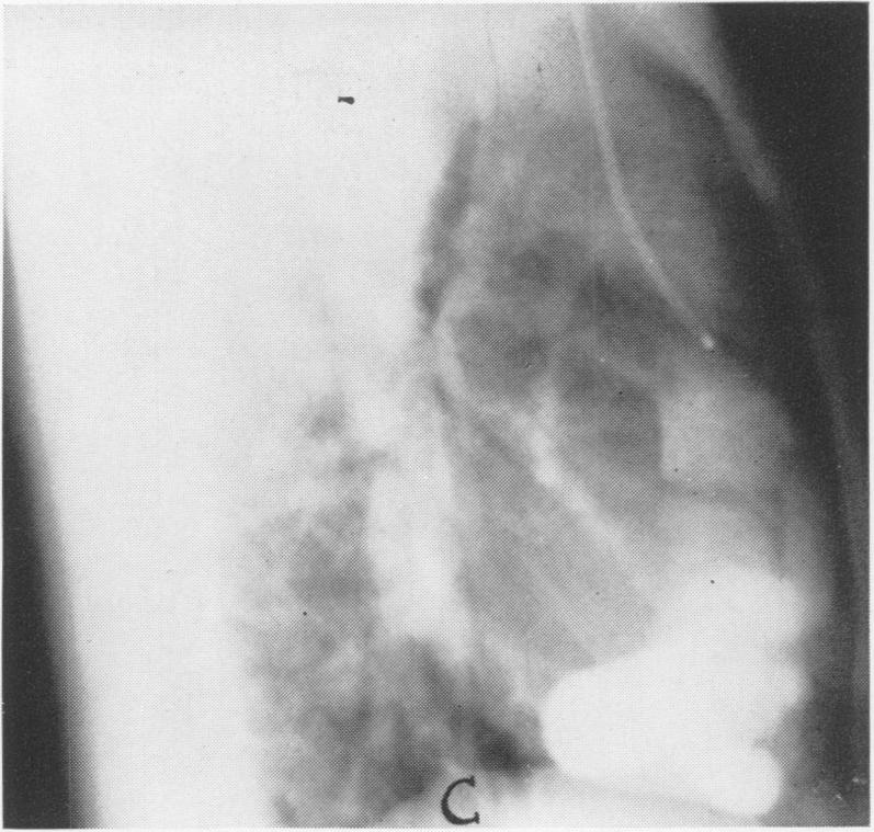 Fig. 1C.