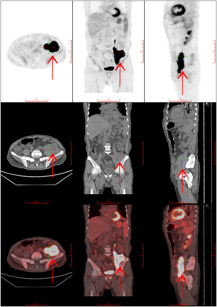 Figure 2