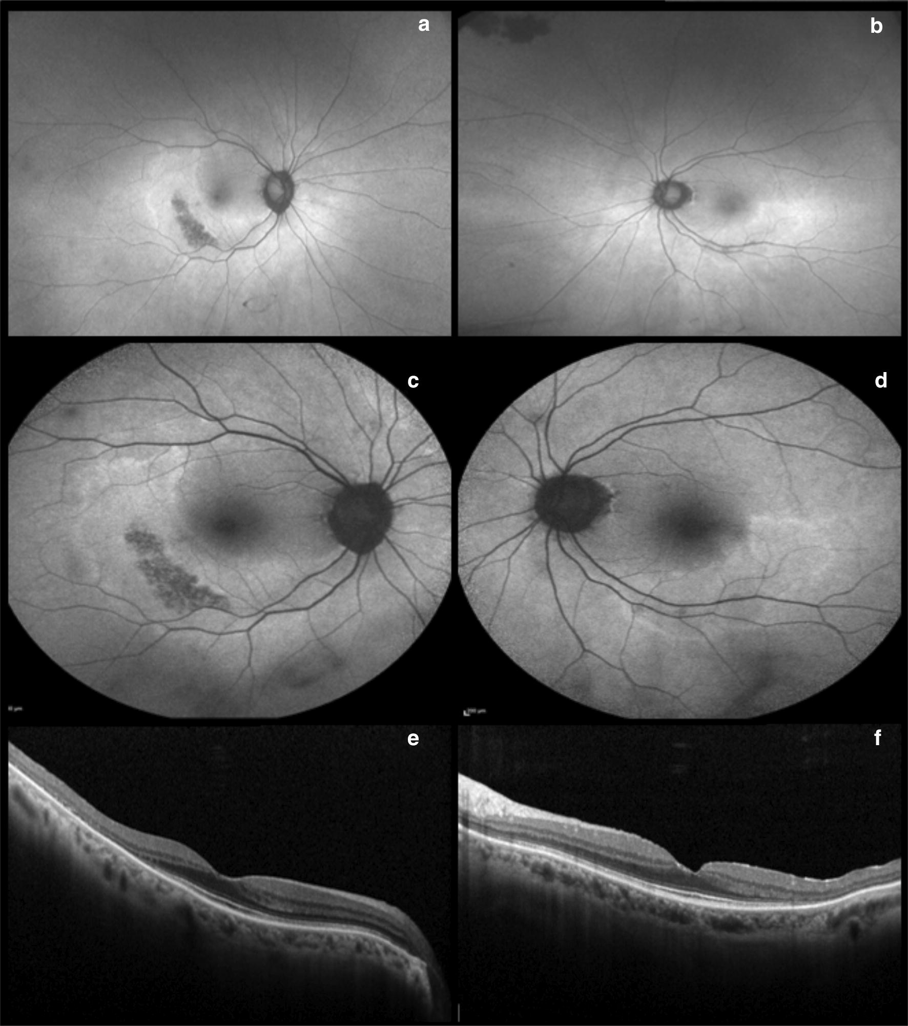 Fig. 2