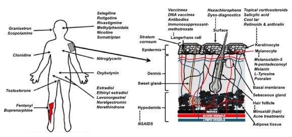 Fig. (1)