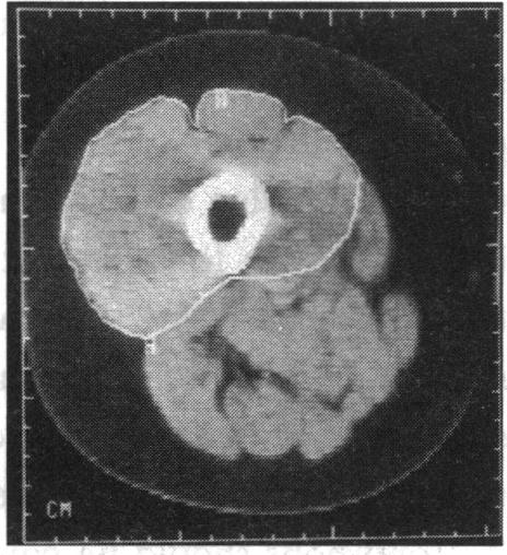 Figure 1 (b)