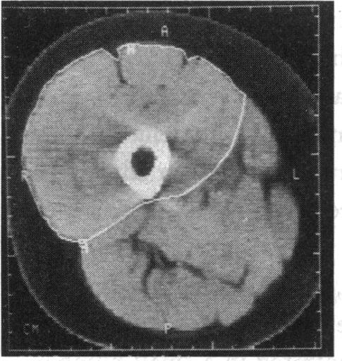 Figure 1 (a)