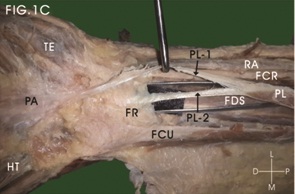 [Table/Fig-1c]: