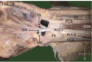 [Table/Fig-1b]: