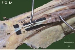 [Table/Fig-1a]: