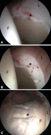 Fig. 6A–C