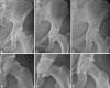 Fig. 1A–F
