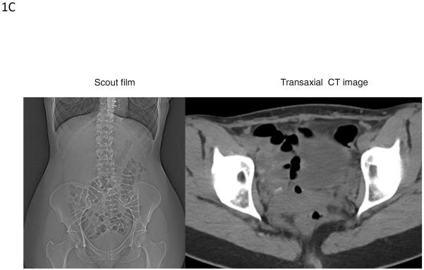 Figure 1C