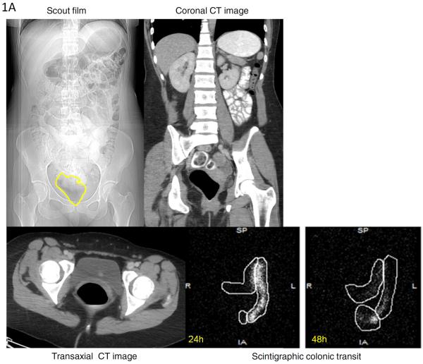 Figure 1A