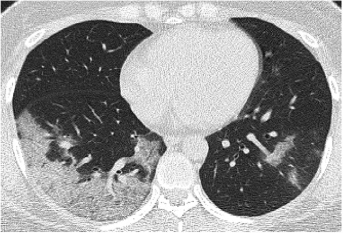 Figure 3b.