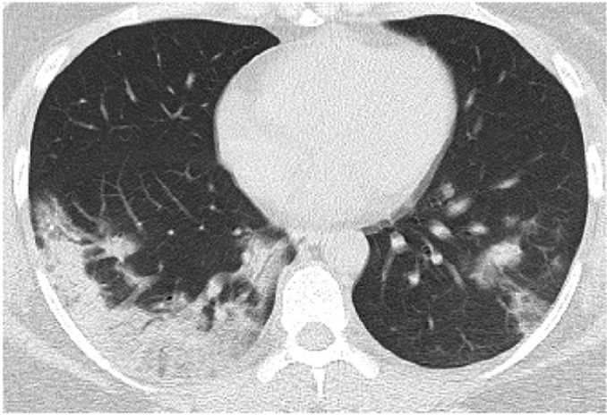 Figure 3c.