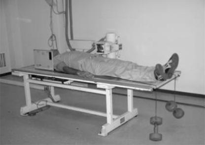 Fig. 2