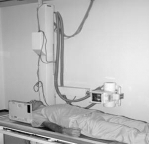 Fig. 1