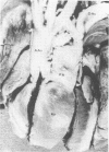 245