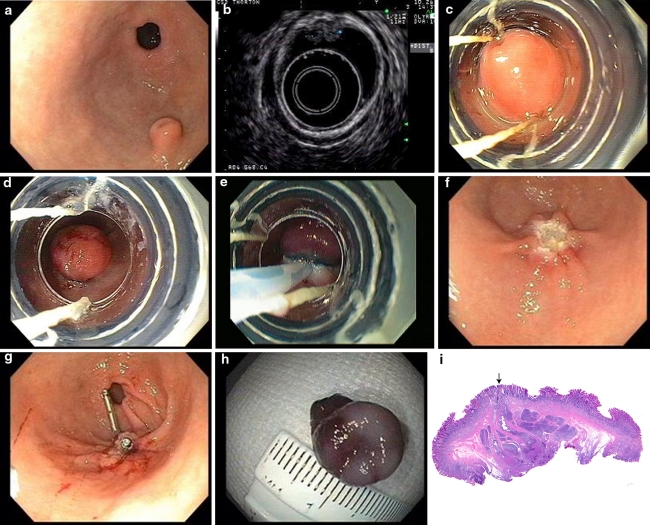 Fig. 1