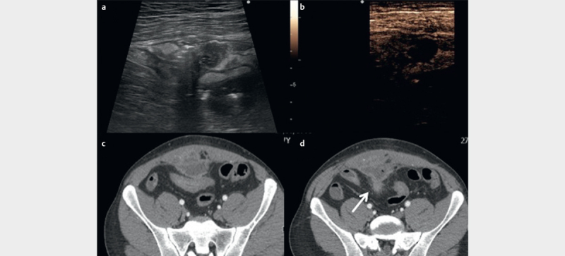 Fig. 10