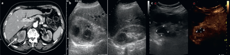 Fig. 11