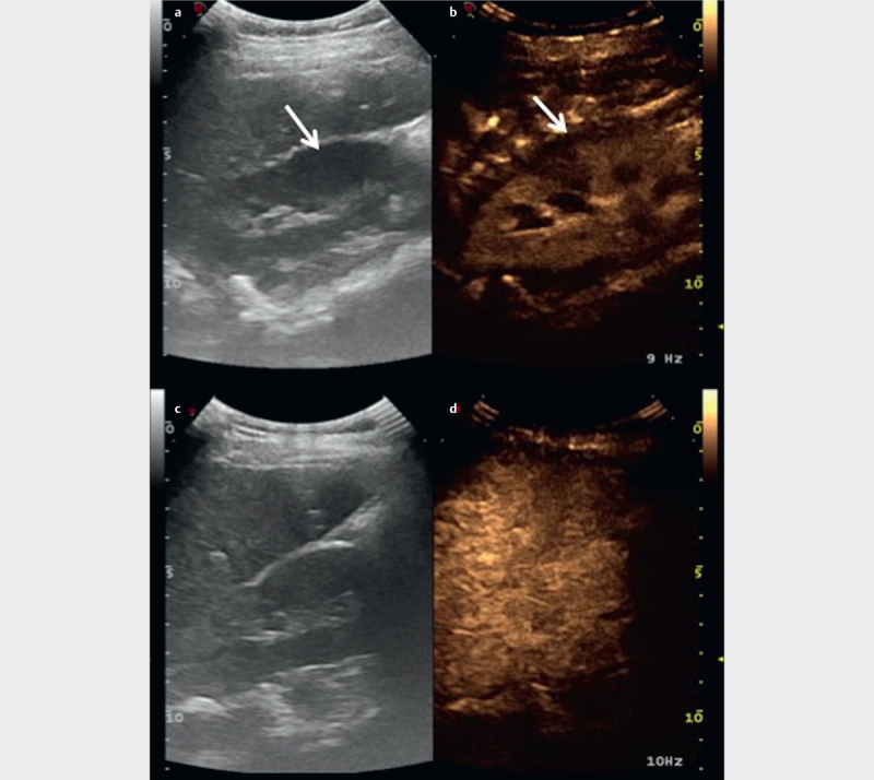 Fig. 12