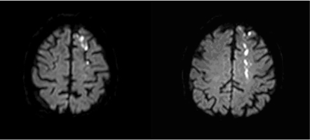 Fig. (2)