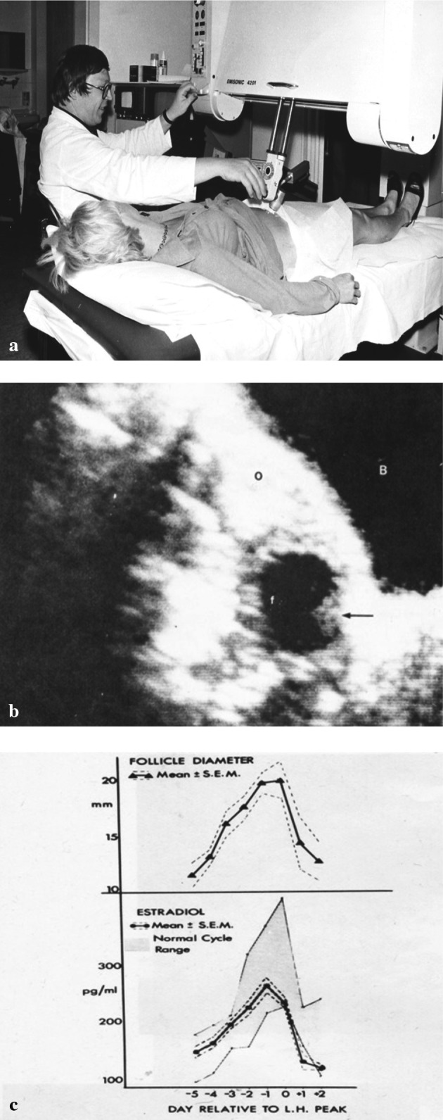 Fig. 14