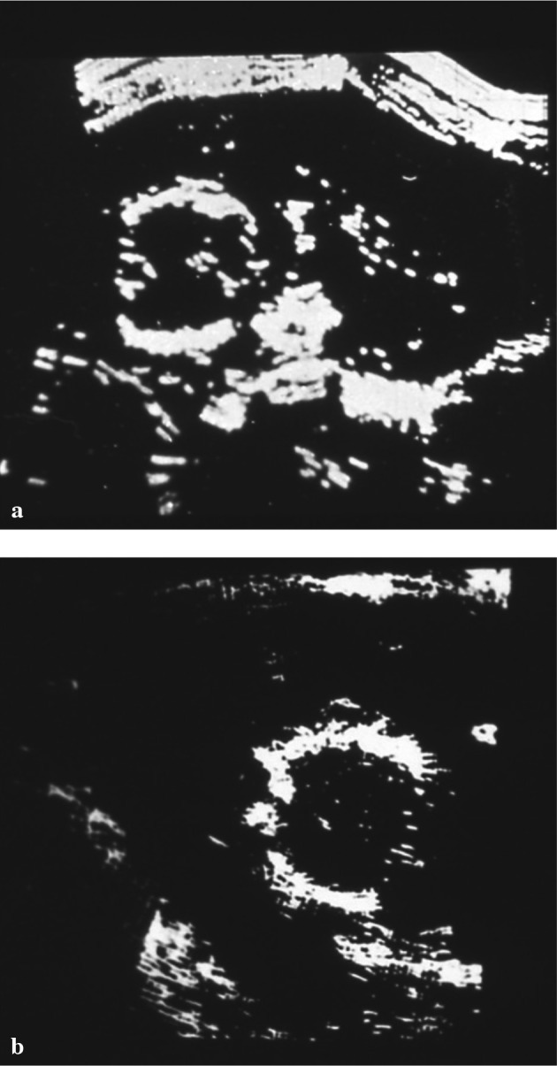 Fig. 10