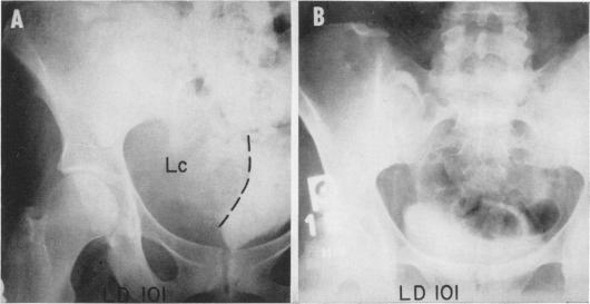 Fig. 11.