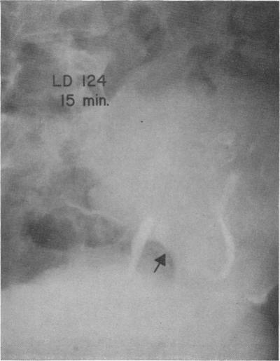 Fig. 13.