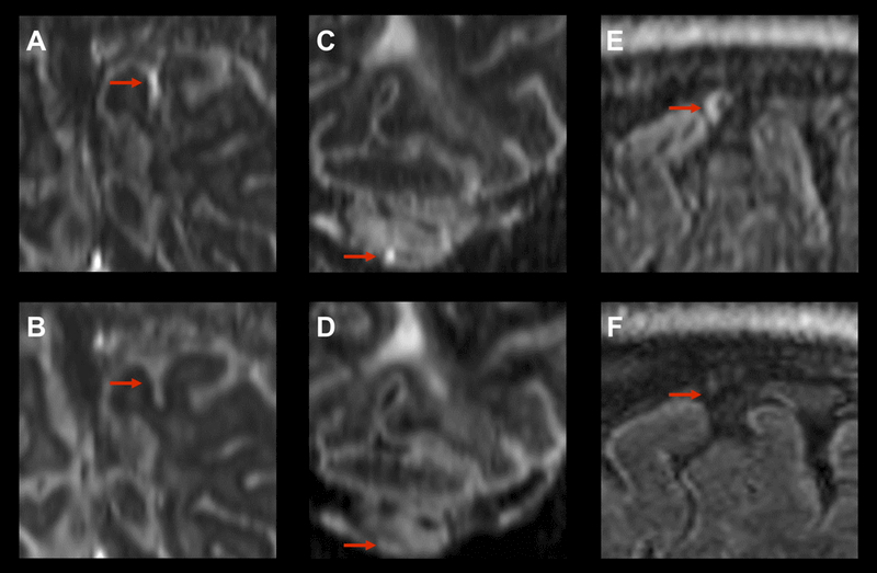 Figure 4: