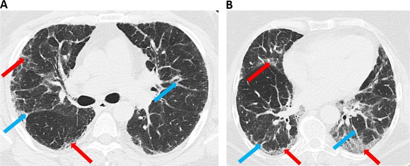 Fig. 2