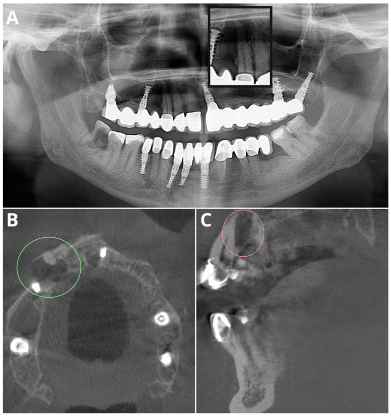 Figure 4