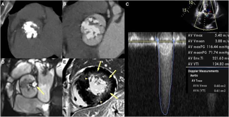 Fig 3