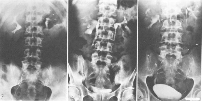 Fig. 2, 3 and 4.