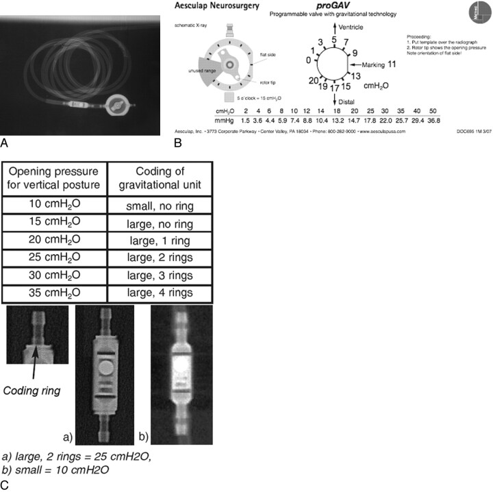 Fig 4.