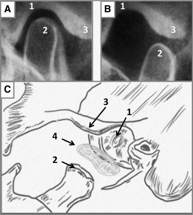 FIG. 1.