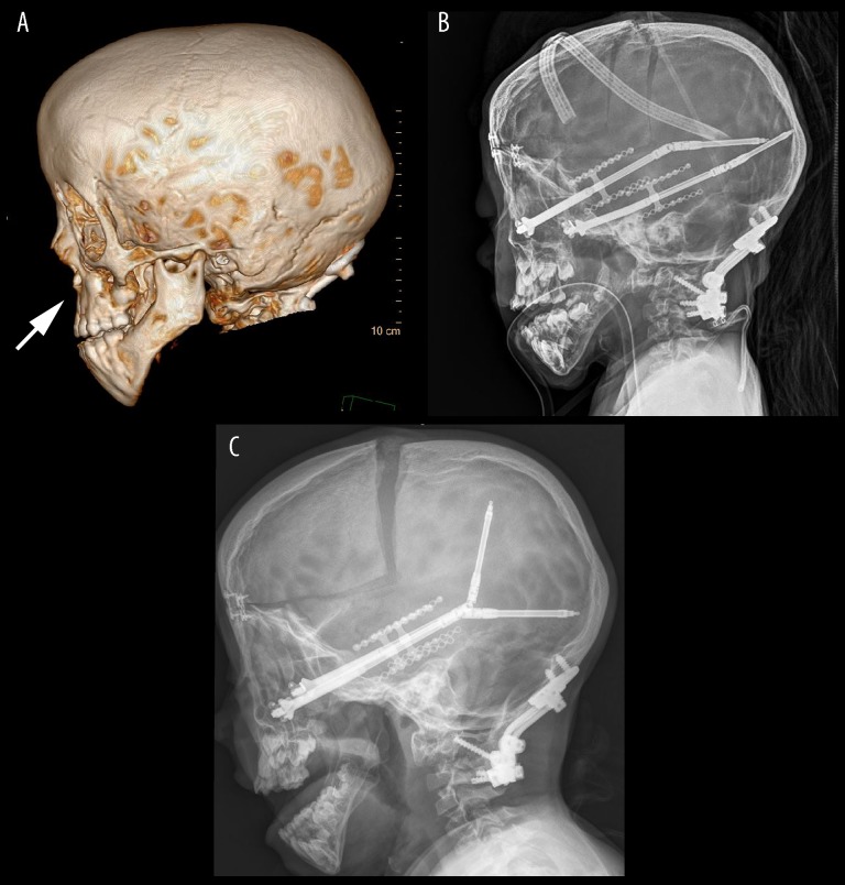 Figure 2.