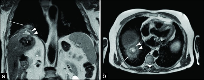 Figure 9: