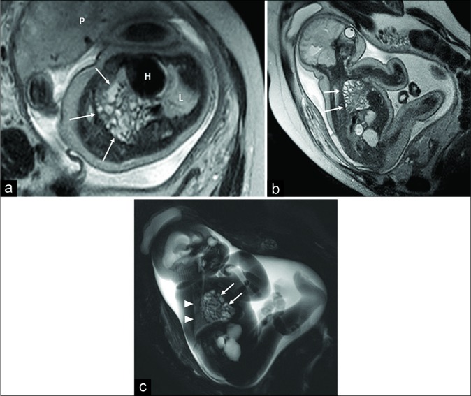 Figure 2: