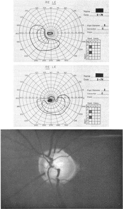 FIGURE 17