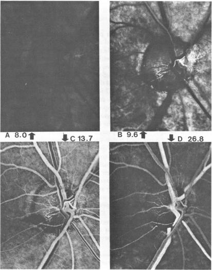 FIGURE 14