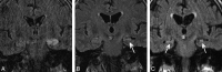 Fig 1.