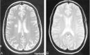 Fig 1.