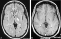 Fig 4.