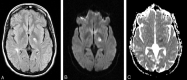 Fig 2.