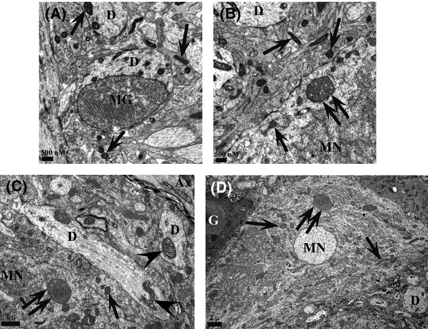 Figure 21