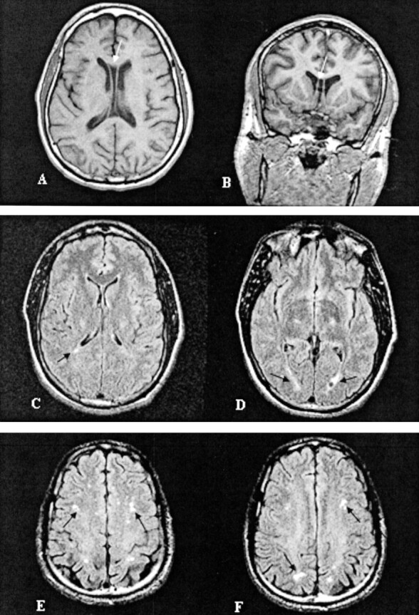 Fig 3.