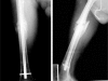 Figure 5 and 6