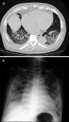 Fig. 3