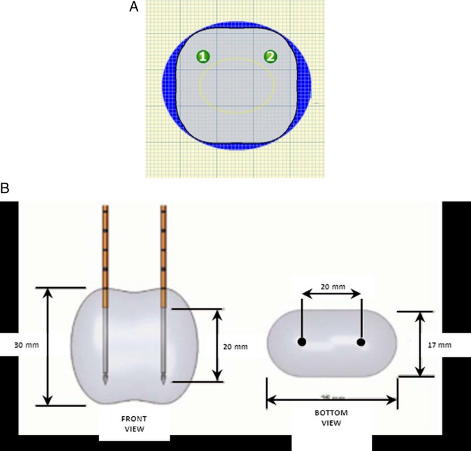 Figure 5